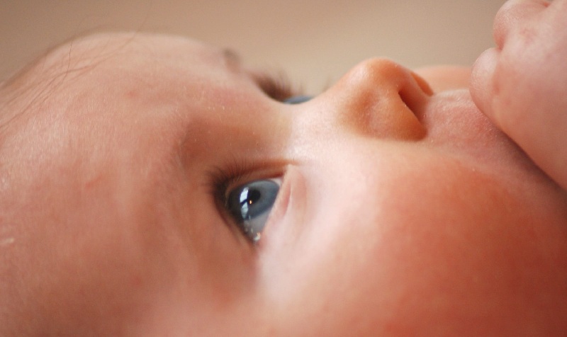 Obstruction Of The Lacrimal Canal In Newborns